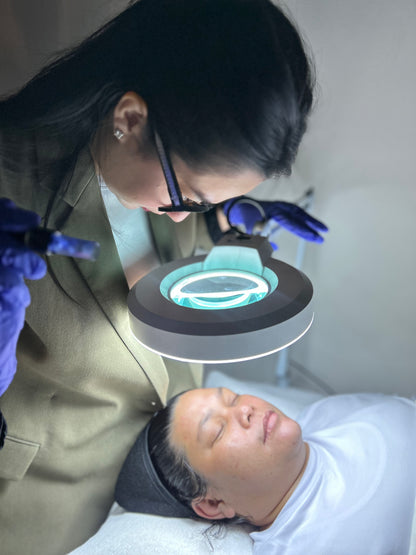 Microneedling